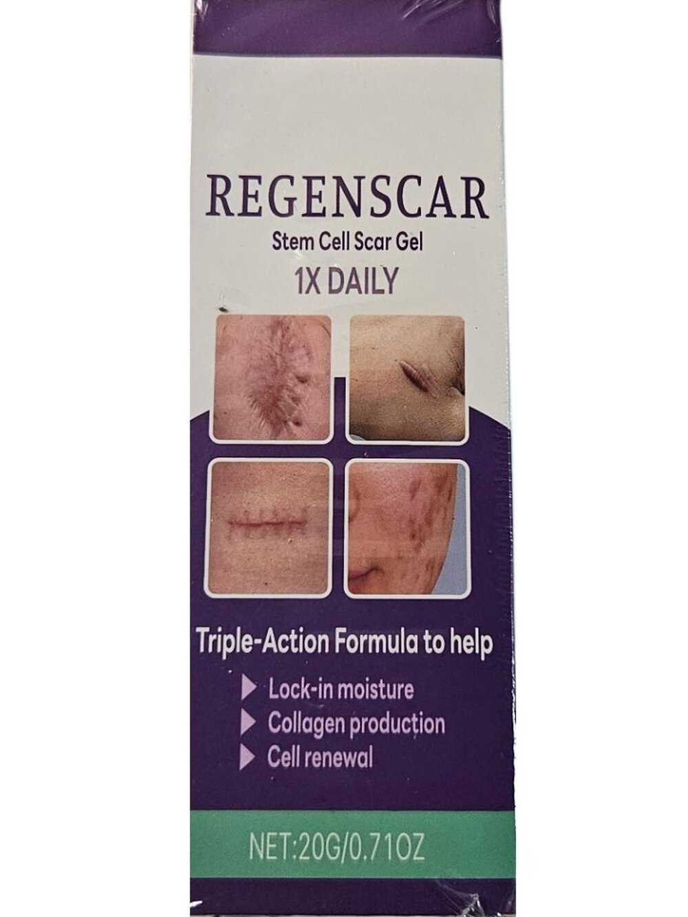 REGENSCAR Stem Cell Scar Gel 1X DAILY – Triple-Action Formula (20g / 0.71 oz)